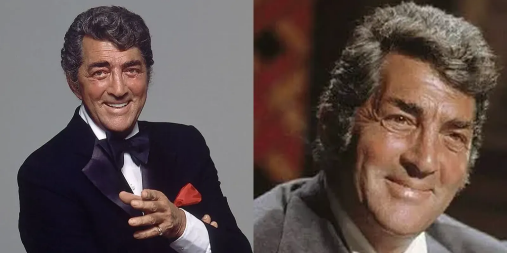 Latest Update on the Dean Martin Hairpiece Rumor: